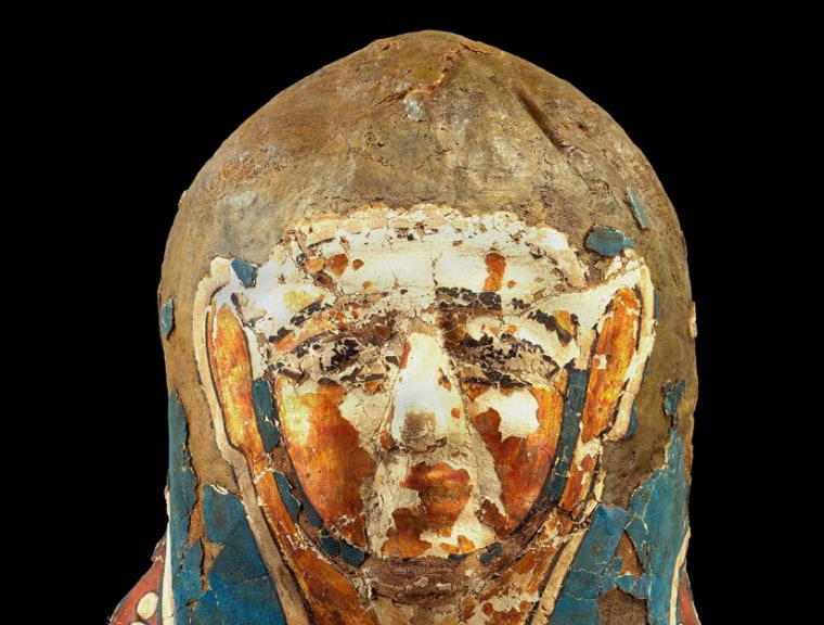 Image: Mummy that showed lesions